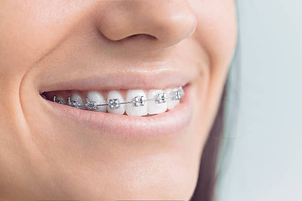 Dental Inlays and Onlays in Bono, AR